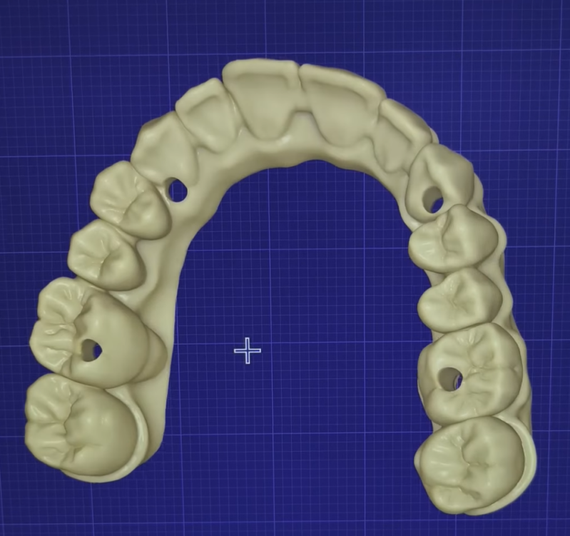 3D visual full arch cad cam design