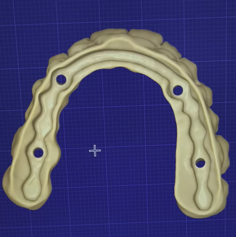 3D visual full arch cad cam design