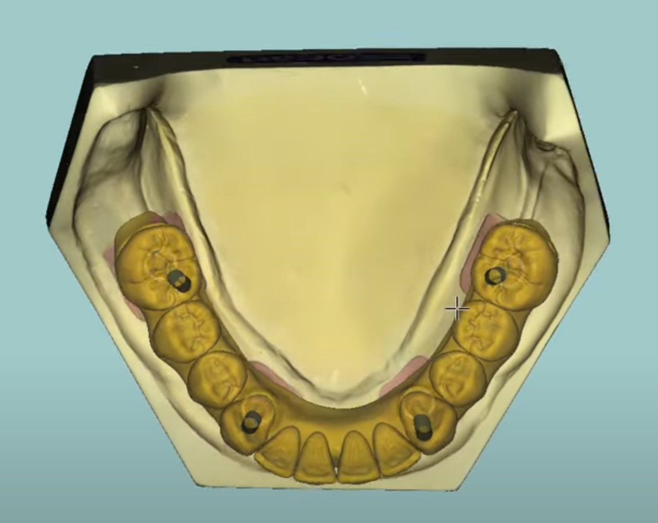 3D visual full arch cad cam design