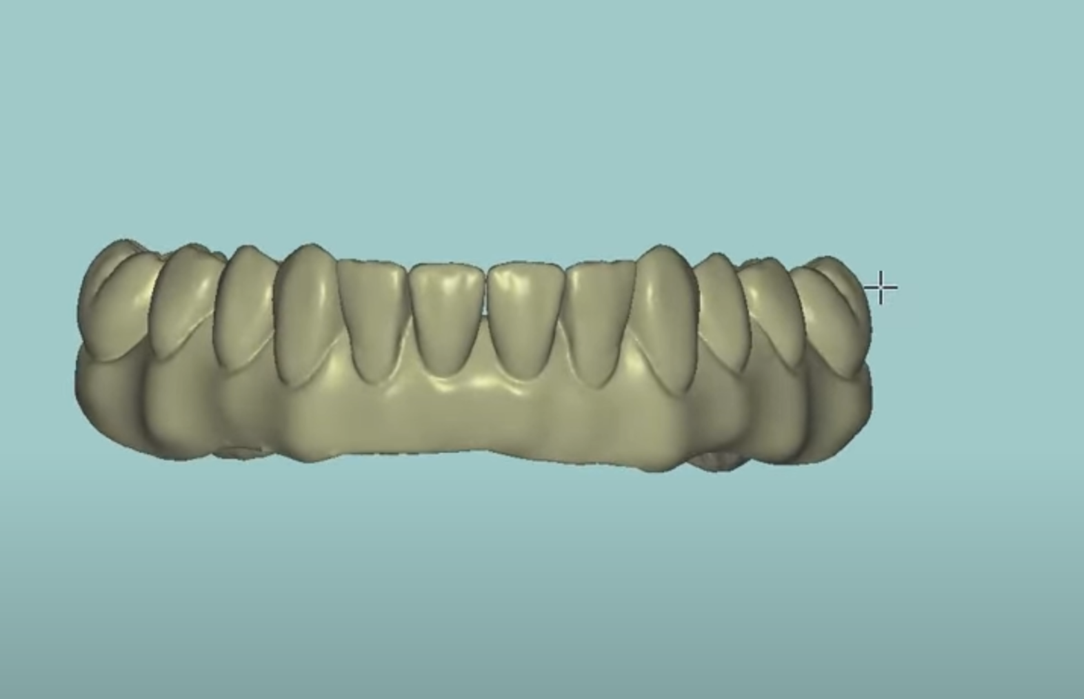 3D visual full arch cad cam design