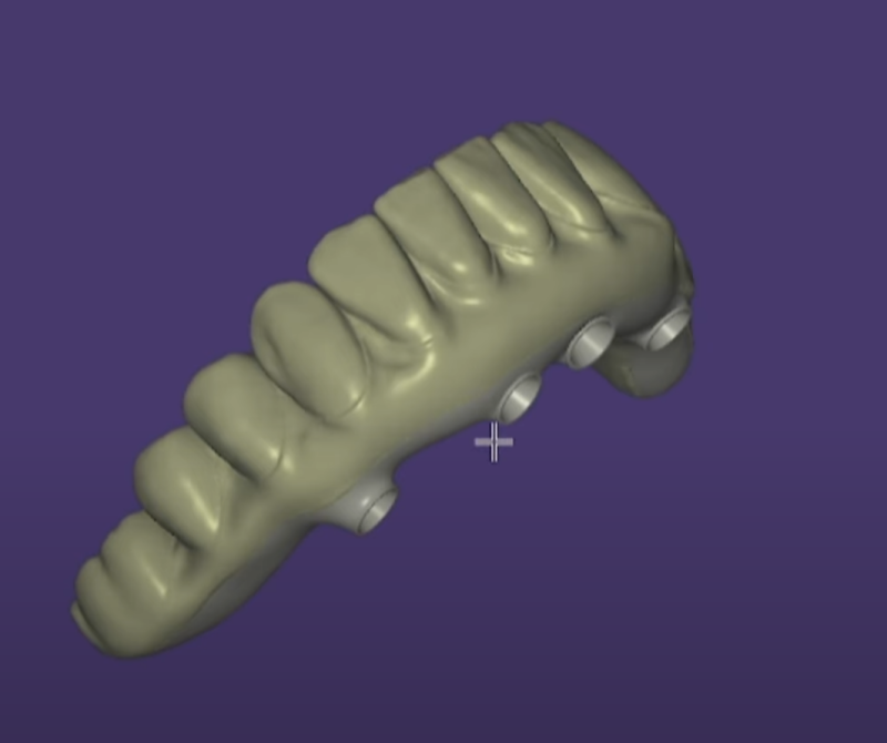 3D visual full arch cad cam design