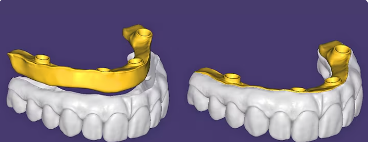 Dual view 3D yellow full arch blenders overnight turnaround CAD rendering for dental arch designs