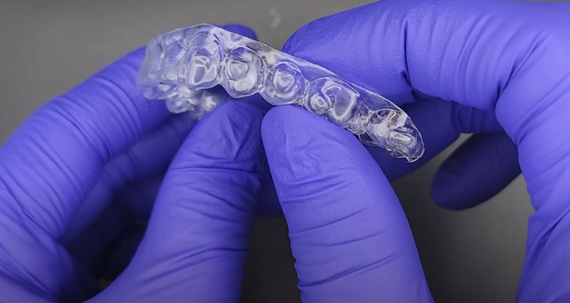 3d clear aligner cad cam finished project