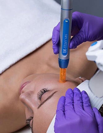 BT Titan Microneedling