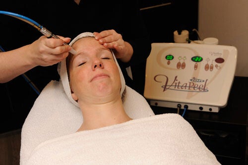 Microdermabrasie