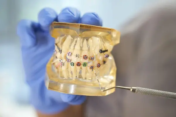 Guide to Children's Orthodontic Readiness in Clementi