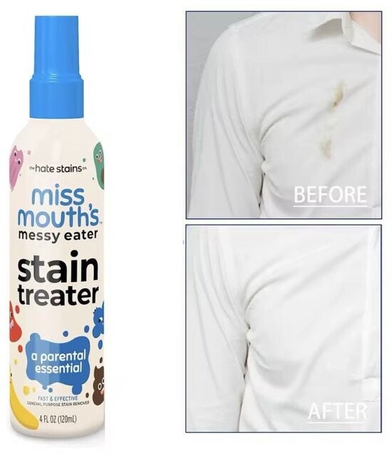 Miss Mouth’s Vlekkenverwijderaar Spray – 120 ml