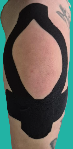knie-andere-standard-vcmotn.png