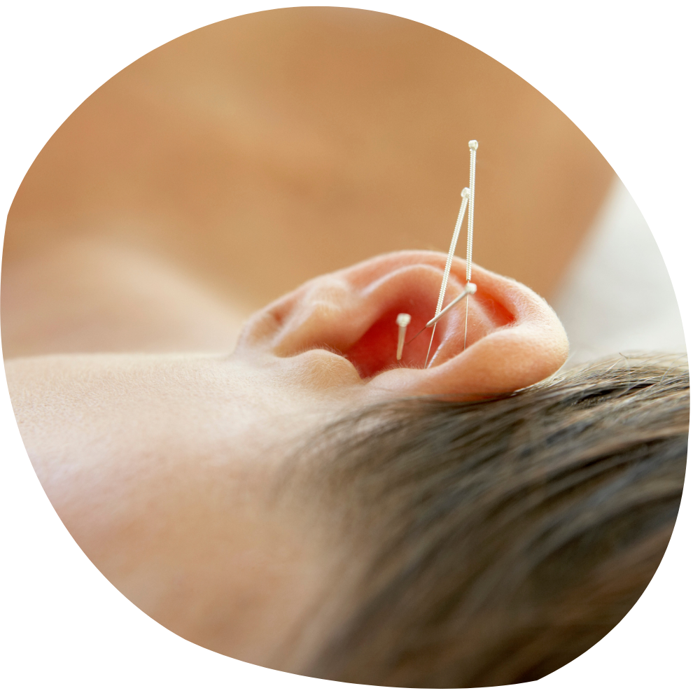 Praktijk Wholistic Acupunctuur Auriculotherapie