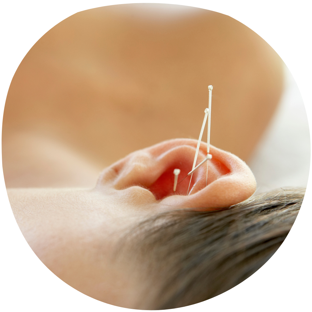 Praktijk Wholistic Acupunctuur Auriculotherapie