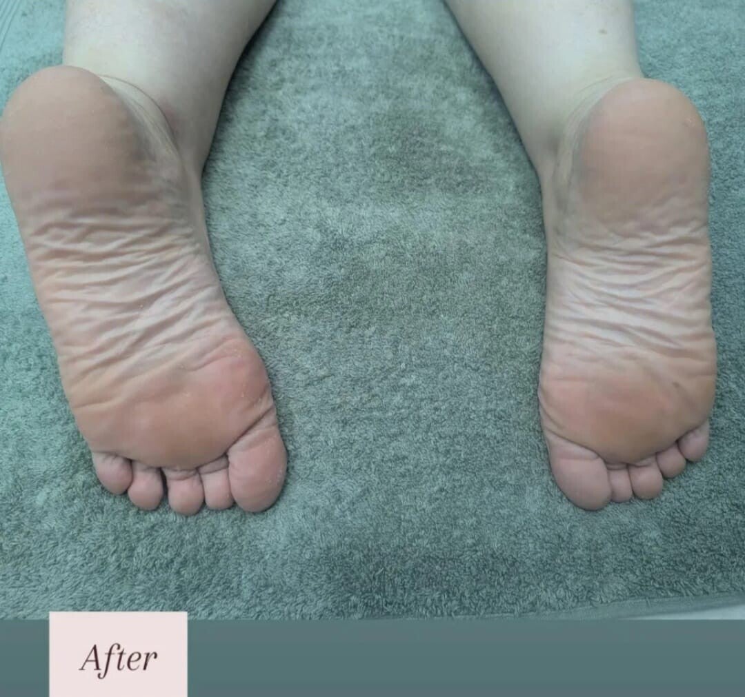 feet-after-standard.jpg