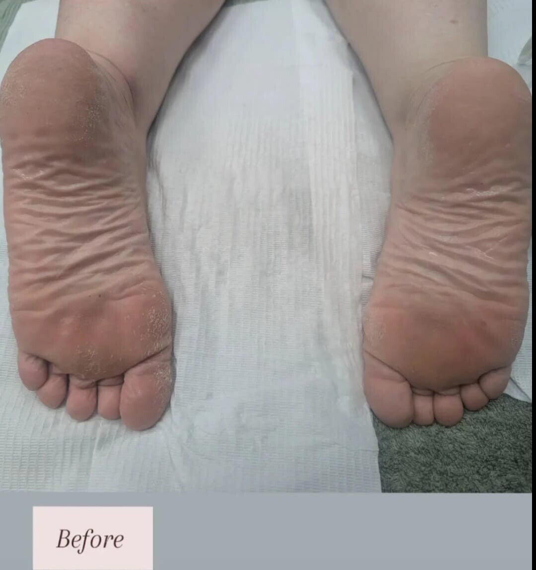 feet-before-standard.jpg