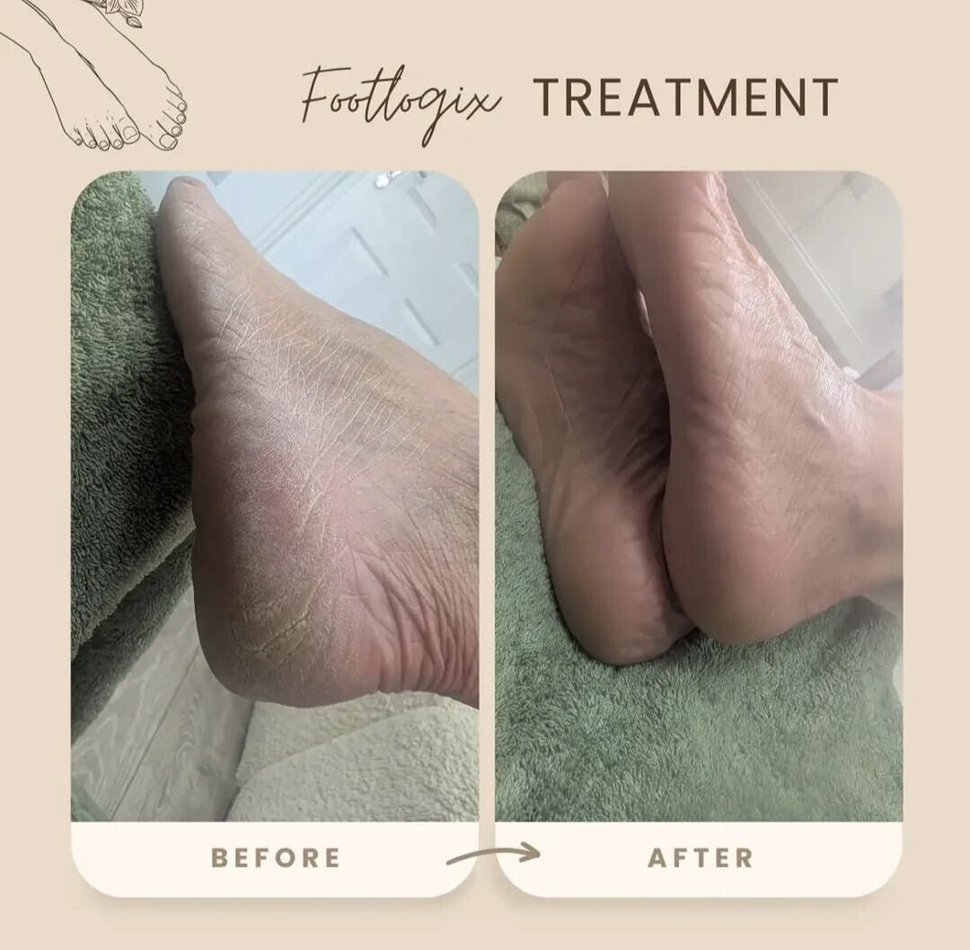 footlogix-ash-standard.jpg