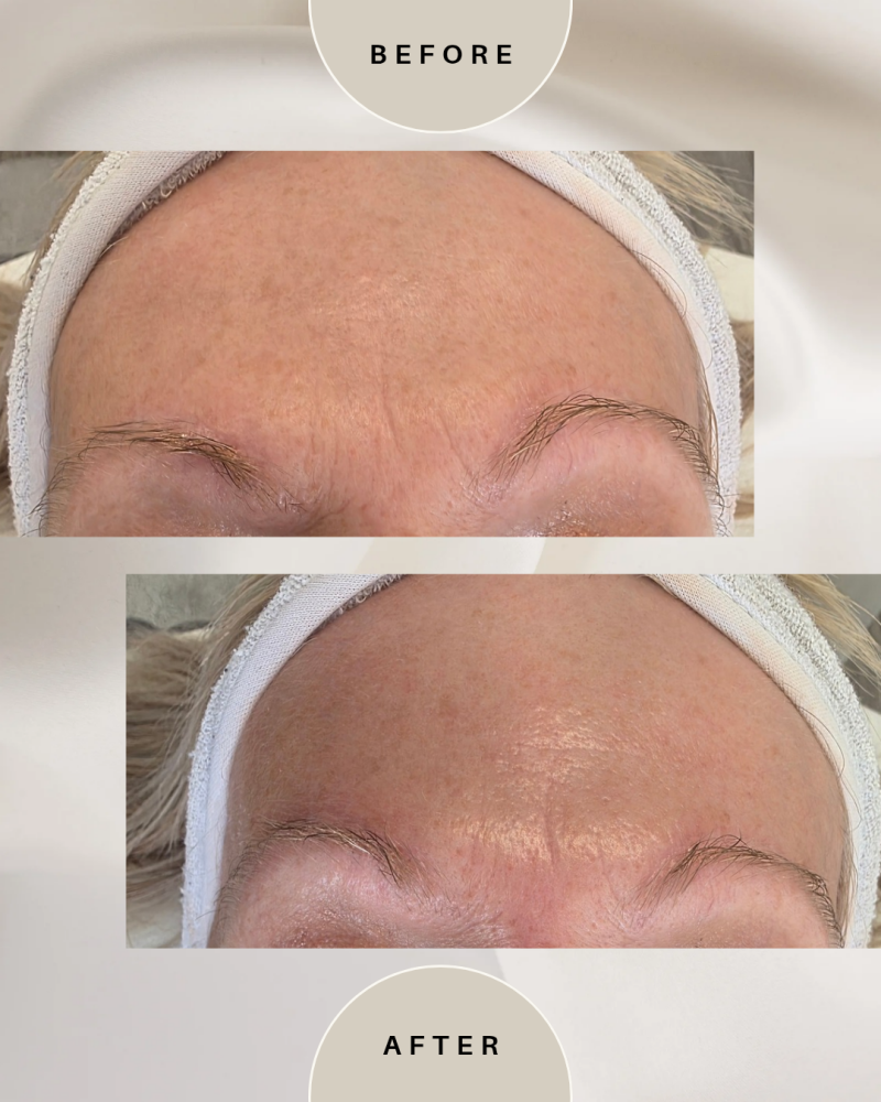 green-and-beige-minimalist-skincare-before-after-collage-instagram-post_20260509_114429_0000-standard-an76qm.png