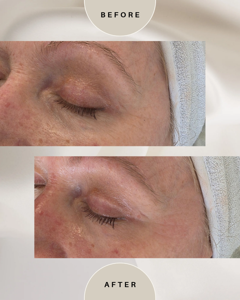 green-and-beige-minimalist-skincare-before-after-collage-instagram-post_20260509_114524_0000-standard.png