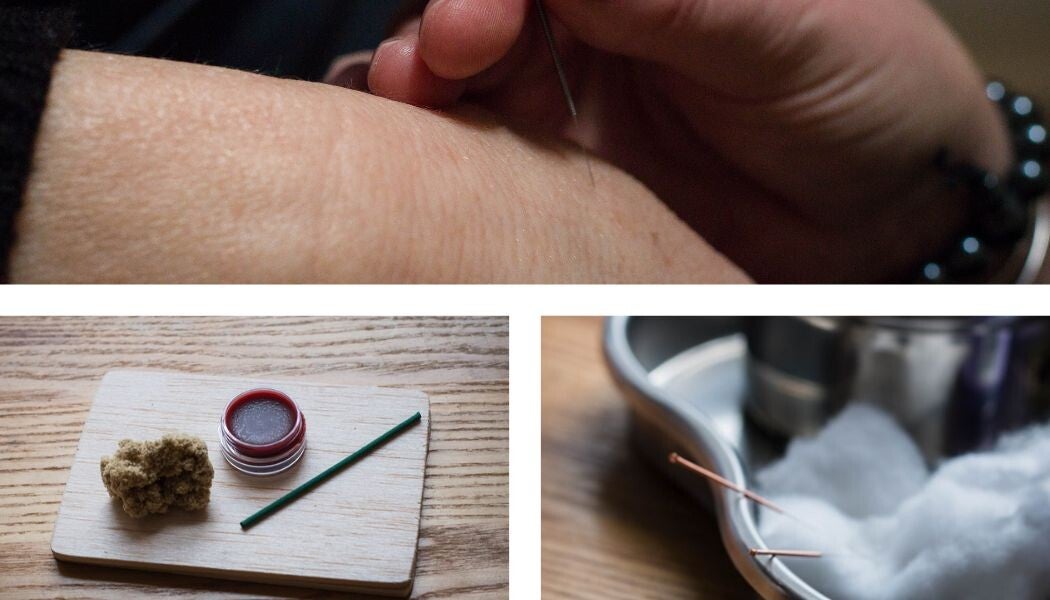 Treatment & Cost Wellpoint Acupuncture