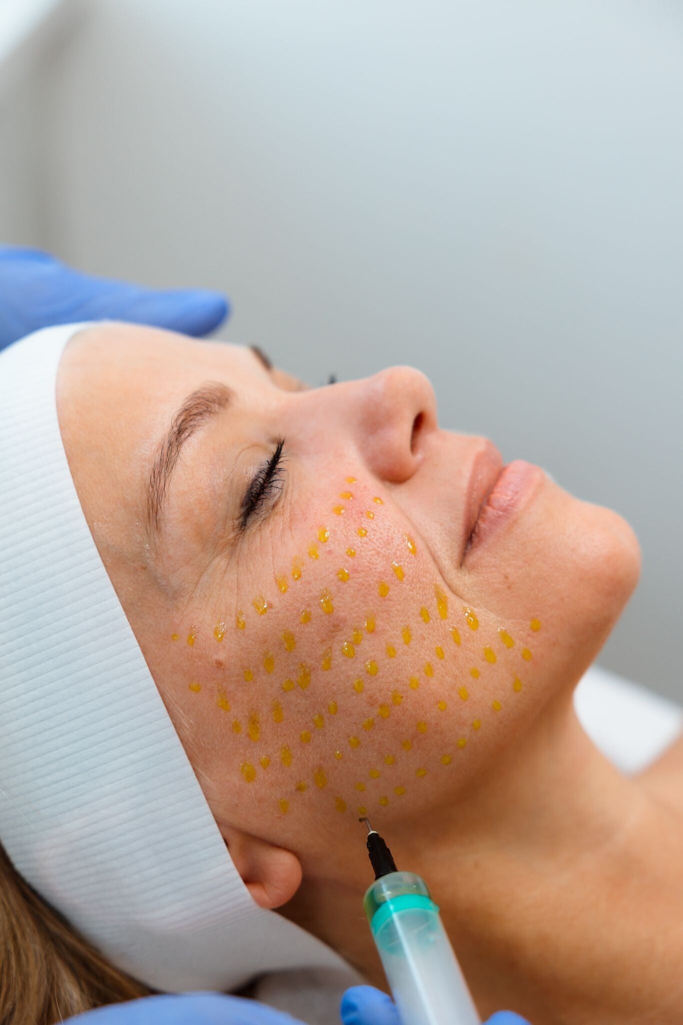 Huidverbetering met Medik8 Facial in salon nabij de Vruchtenbuurt / Vogelwijk, Den Haag