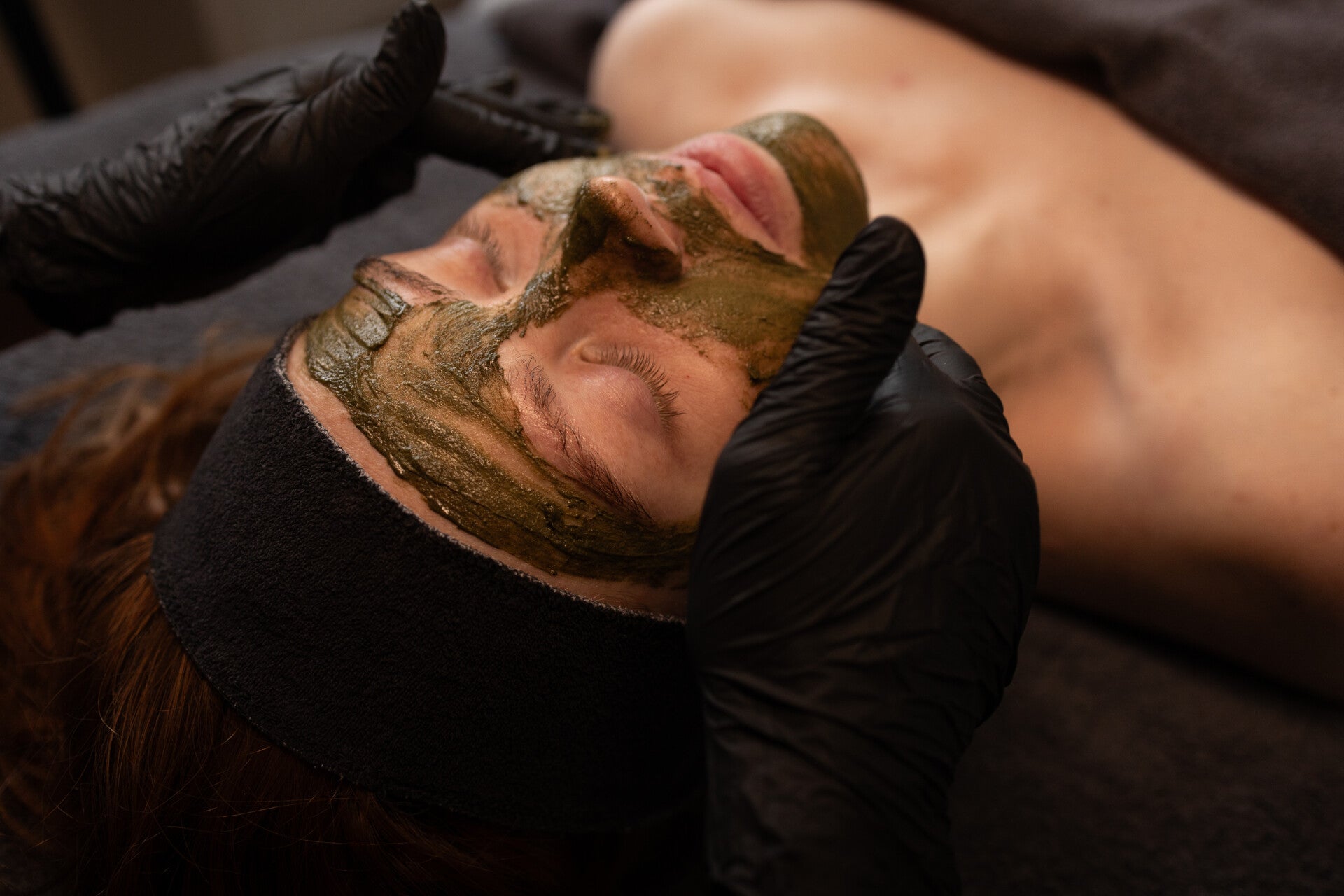 bio peeling den haag