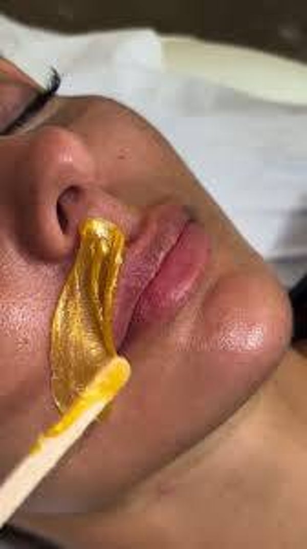 Épilation visage - dépôt 30 %