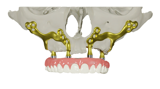 Kaak+ kaakchirurg MKA chirurg malle azvoorkempen lier brecht turnhout zoersel