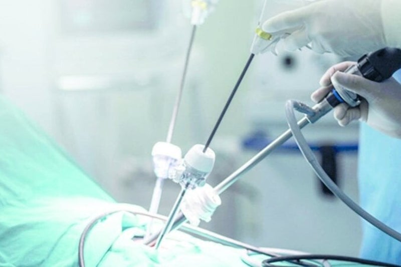 Endometriosis Surgery Cyprus