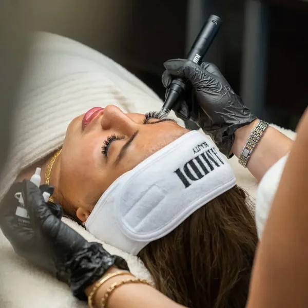 Microneedling Deluxe