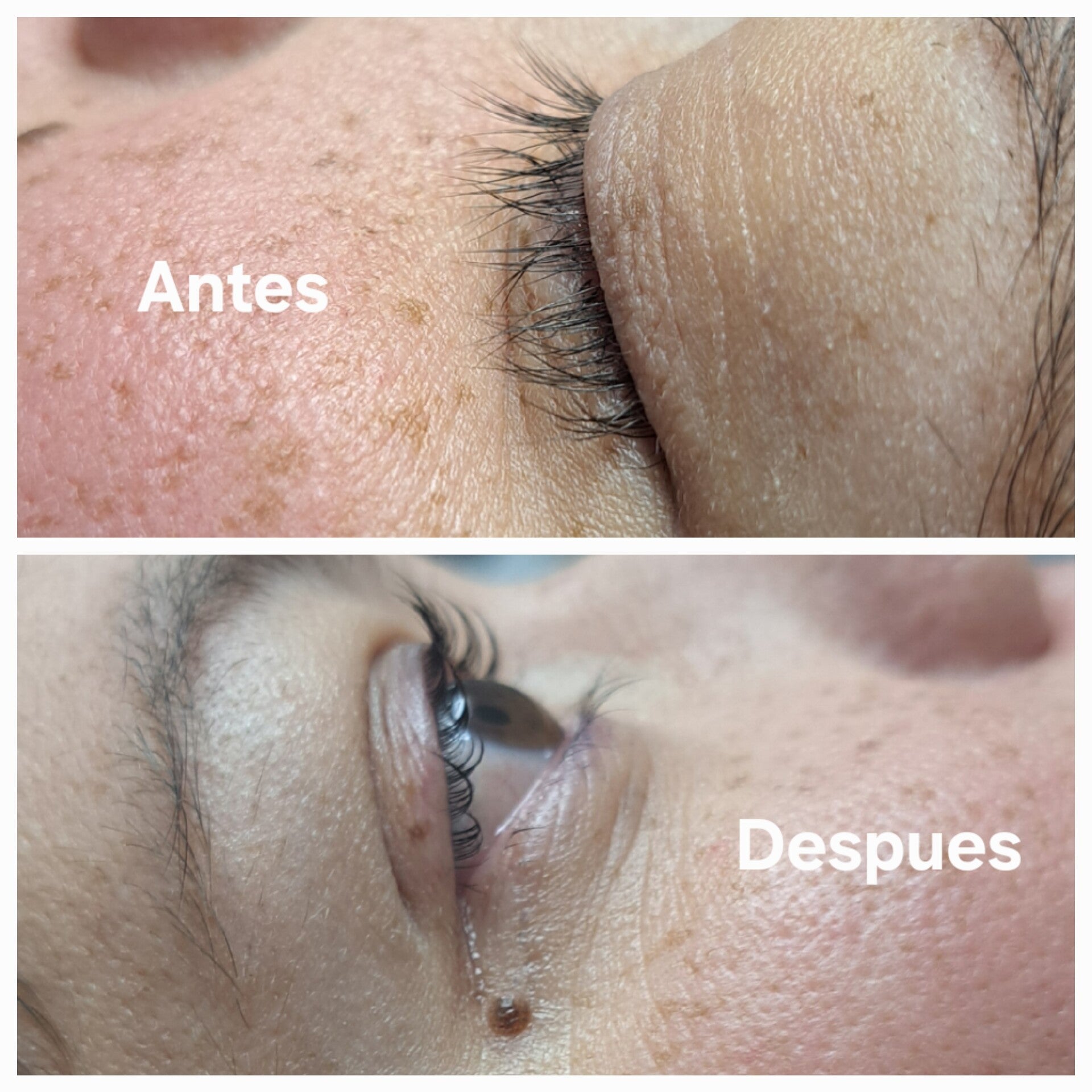 Lifting de pestañas