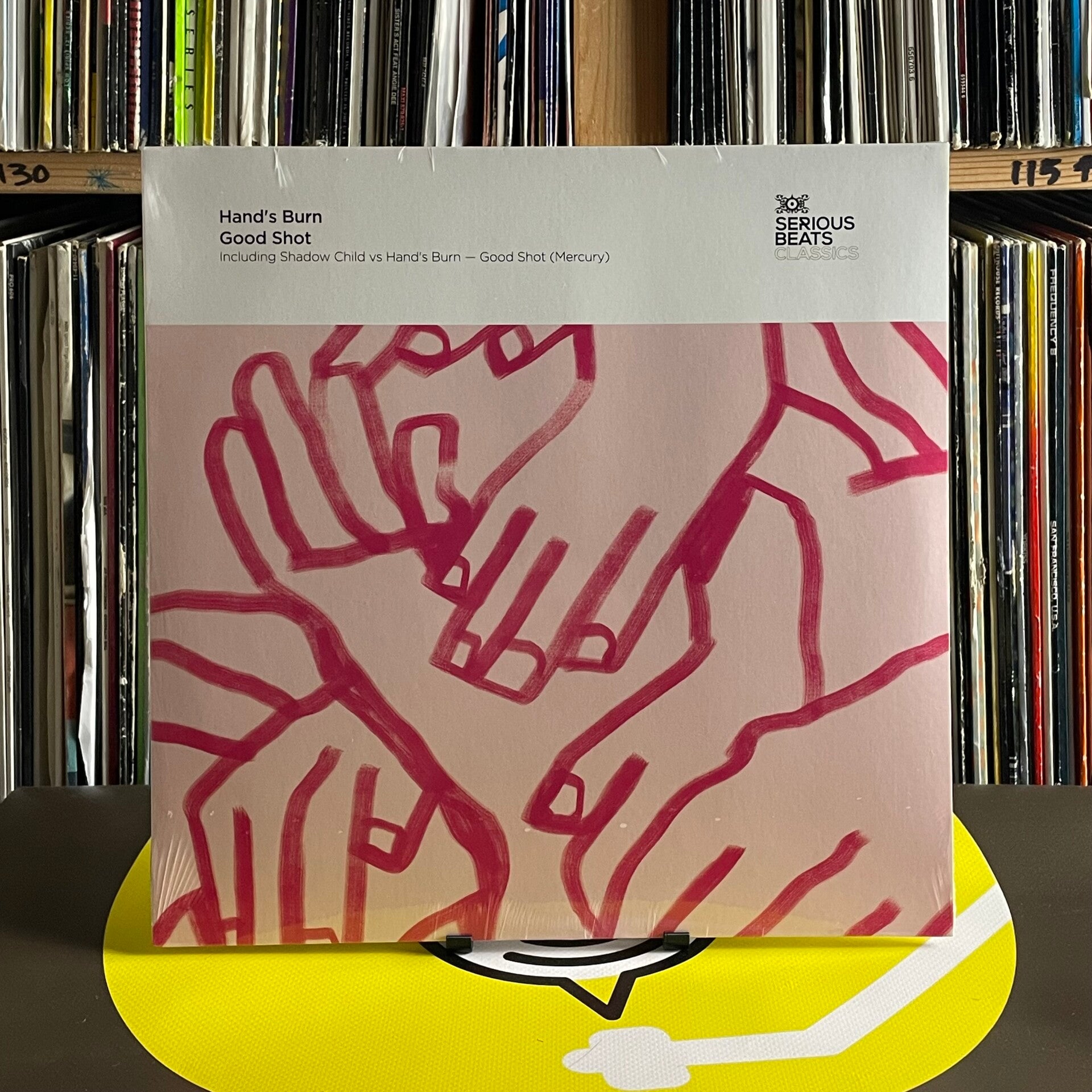 Hand's Burn - Good Shot