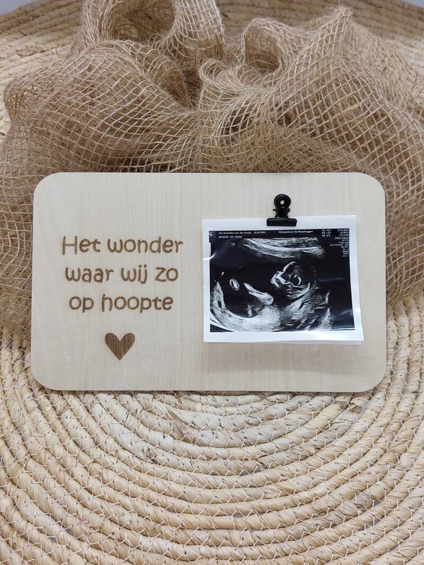 Clipboard Het wonder waar wij zo op hoopte