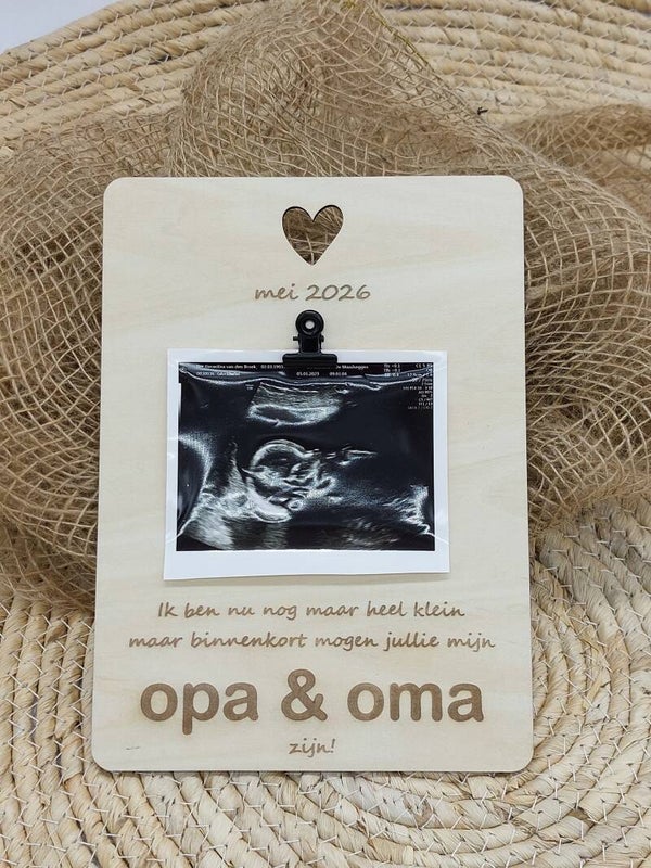Clipboard zwangerschapsaankondiging