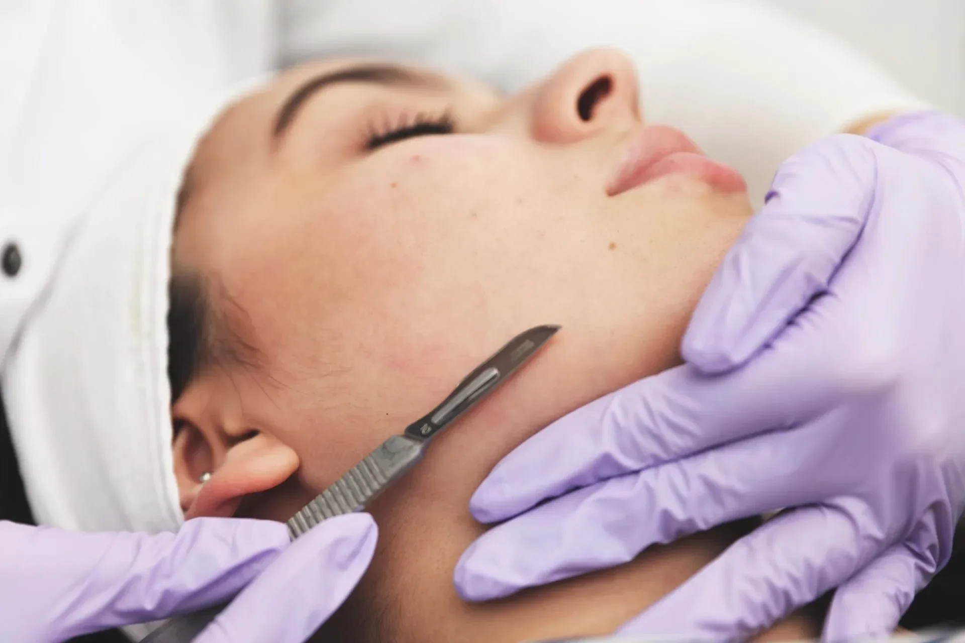 dermaplane online