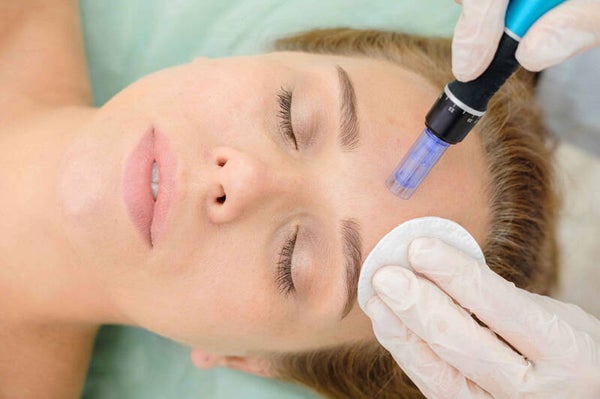 microneedling online