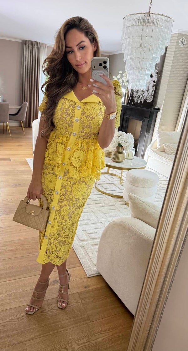 Yellow Button Dress