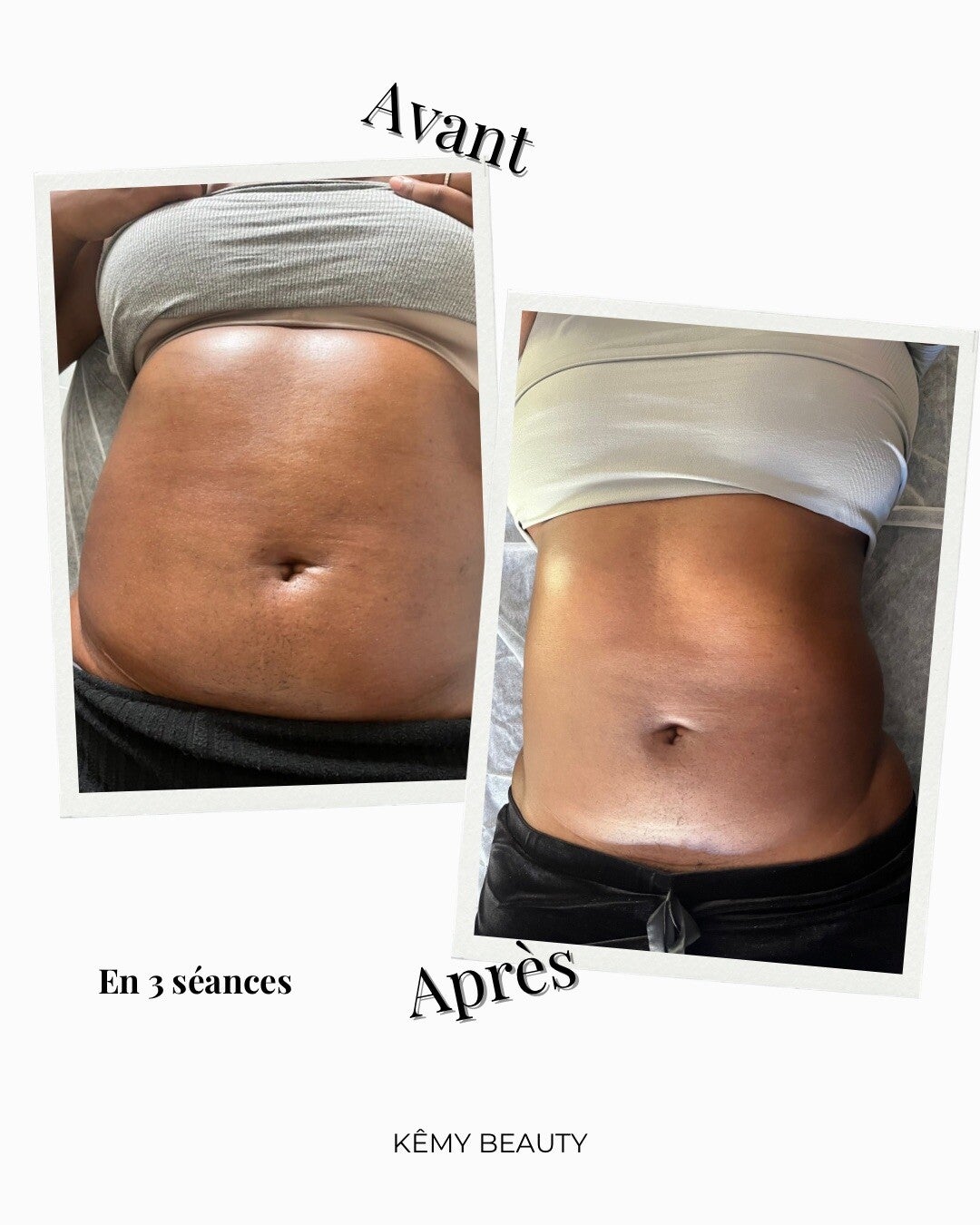 publication-instagram-cosm-tiques-avant-apr-s-minimaliste-collage-photo-beige-1-standard-cx8ep2.jpg