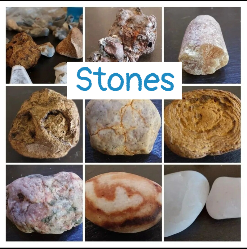 Stones