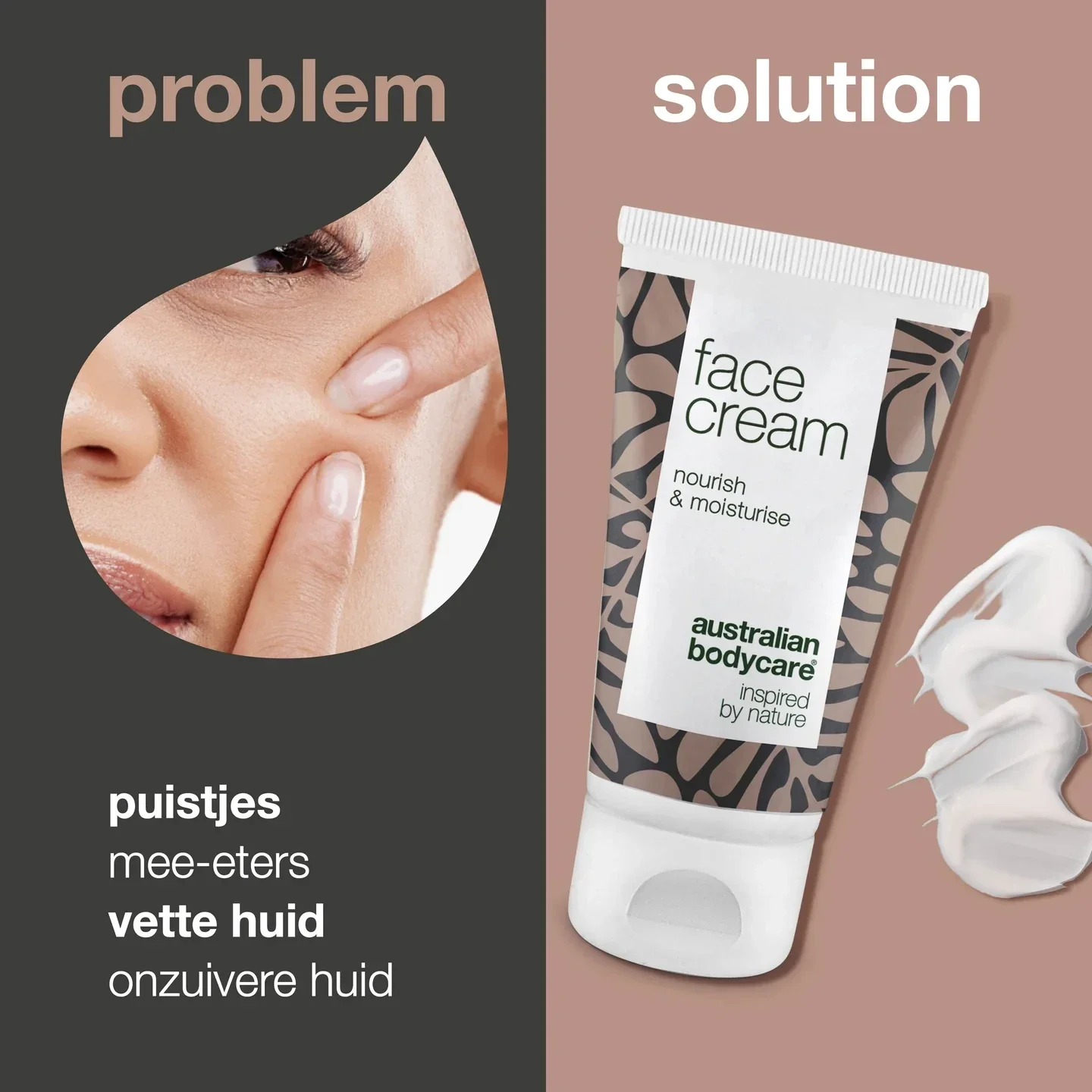 Anti-Puistjes Gezichtscrème Hydraterende crème, perfect tegen pukkels, jeugdpuistjes & mee-eters