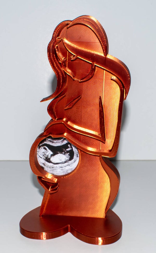 Baby Scan Holder/Frame