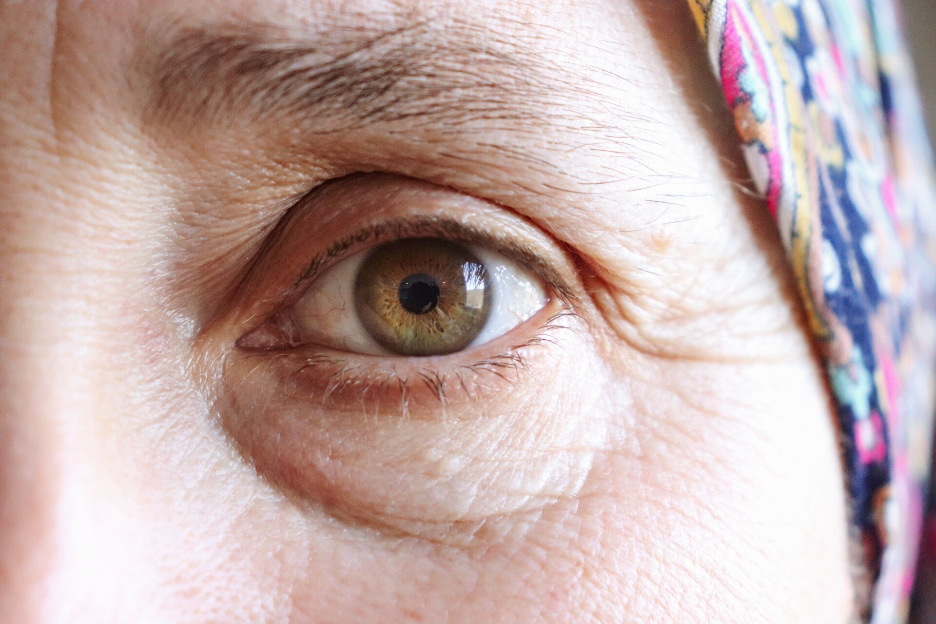 Primer plano del contorno de ojos de una mujer con arrugas finas