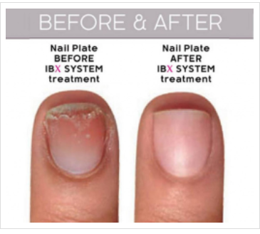probleemnagelbehandelingen met het IBX systeem. Boost je natuurlijke nagel en geniet weer van mooie handen en nagels