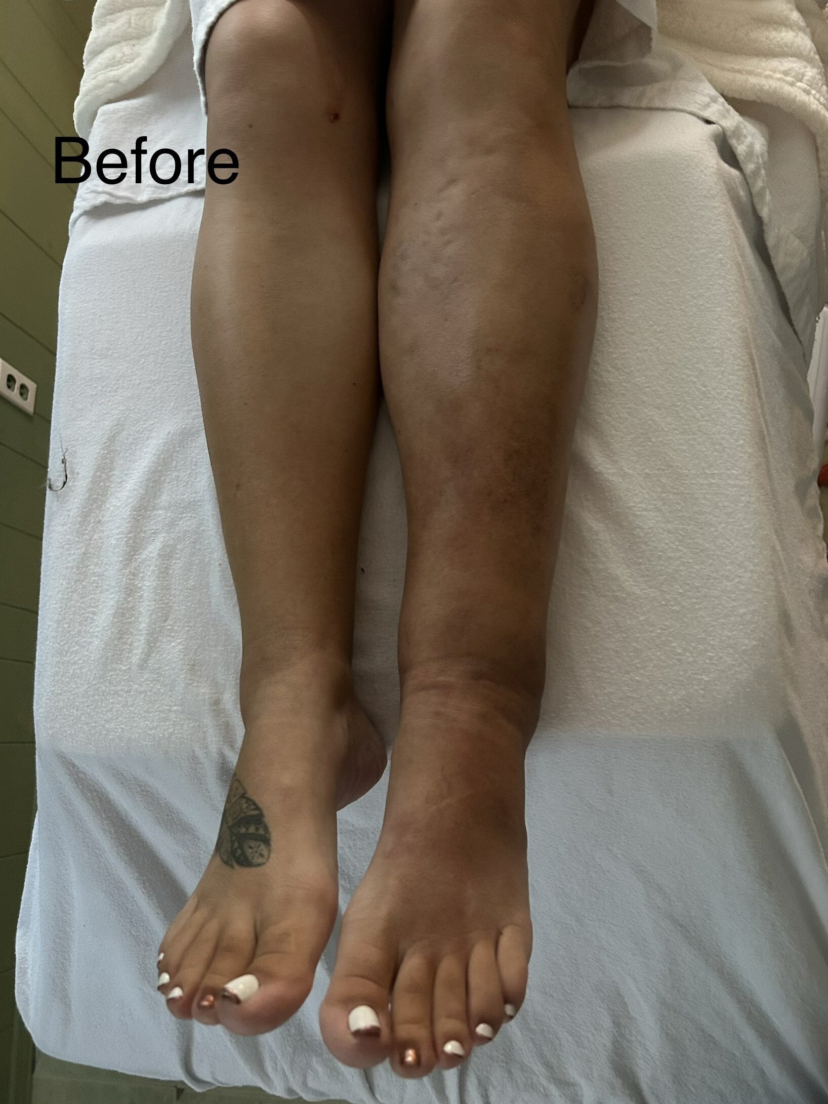 leg-1-standard-qatevz.jpg