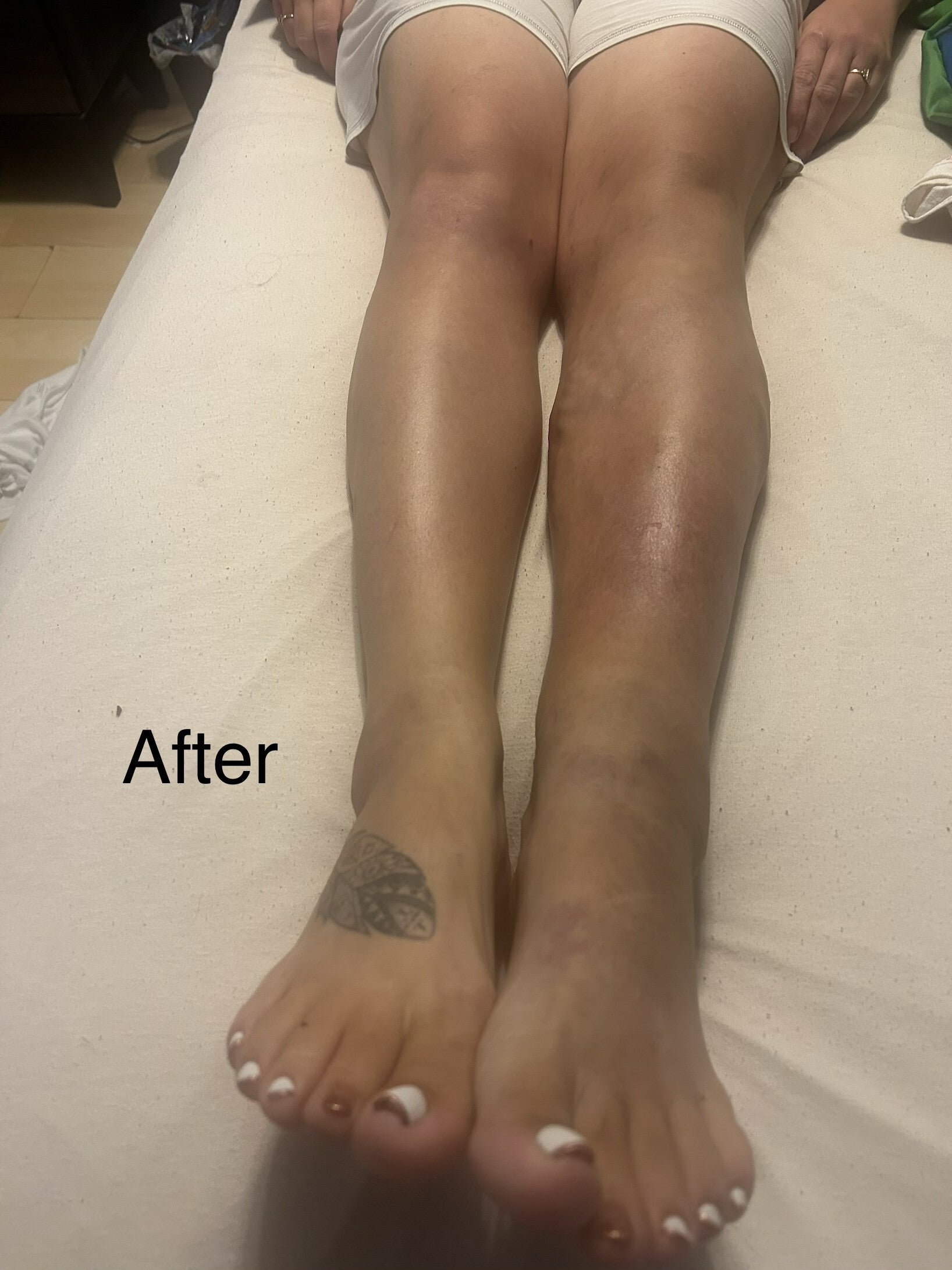 leg-2-standard.jpg