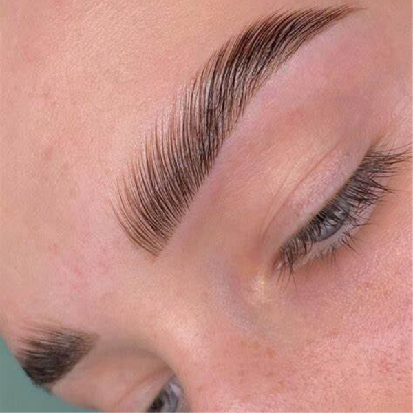 Browlift