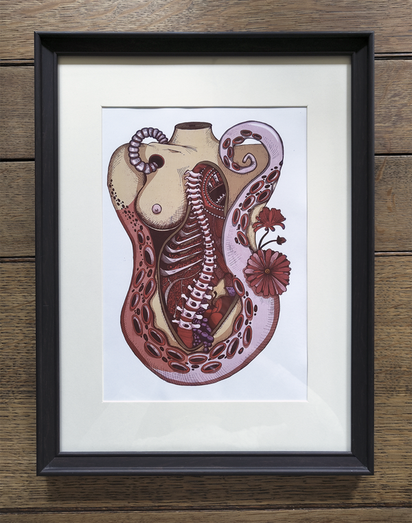 Spinal pain - print art