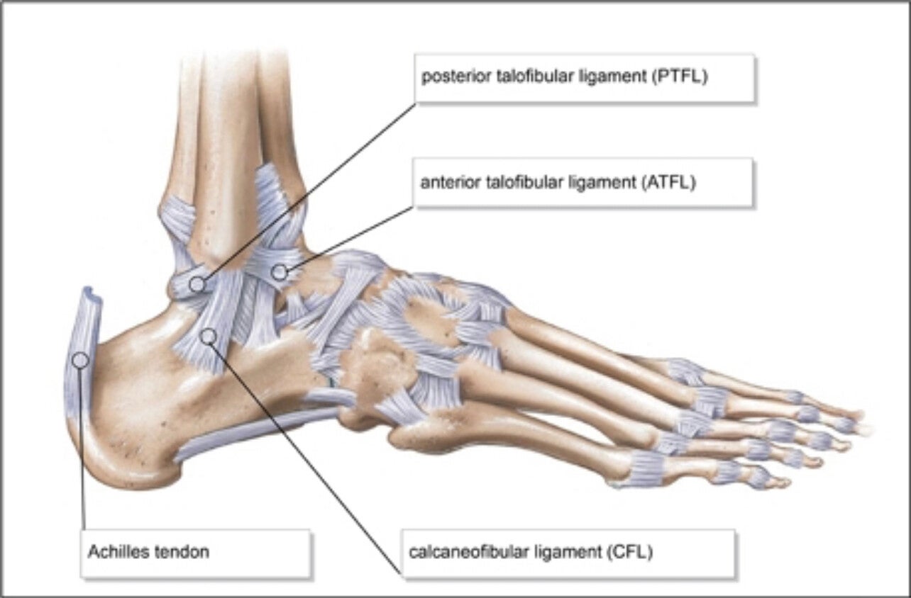 Ankle Sprains And Anterior Talofibular Ligament ATFL Reconstruction Ankle Sprains And Anterior Talofibular Ligament ATFL Reconstruction