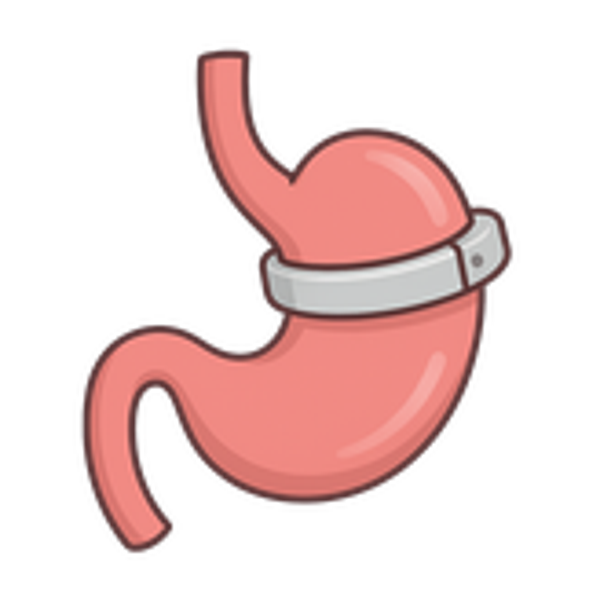 Anneau gastrique virtuel