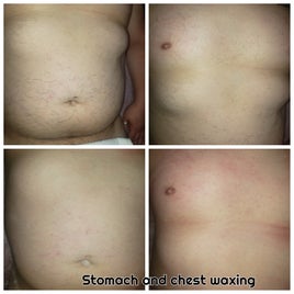 carlos-chest-stomach-standard.jpg