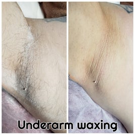 carlos-underarm-1-standard.jpg