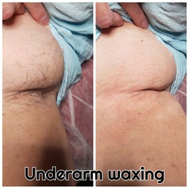 maliana-underarm-standard.jpg