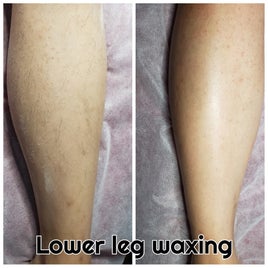 robertson-lower-leg-standard.jpg