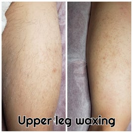 robertson-upper-leg-standard.jpg
